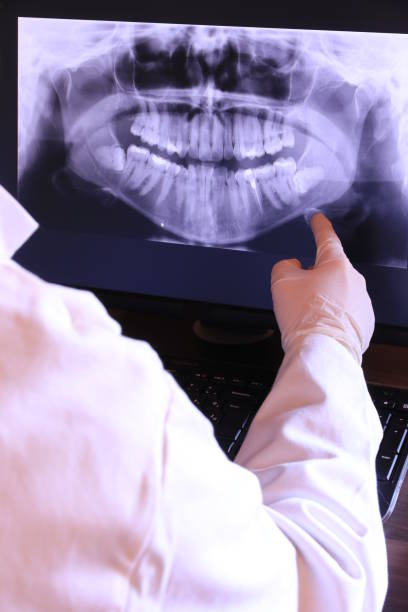 Best Dental Abscess Treatment in Imperial, NE